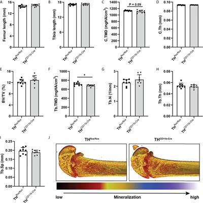 Myeloid cell-derived catecholamines influence bone turnover and regeneration in mice